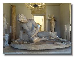 Dying Gaul